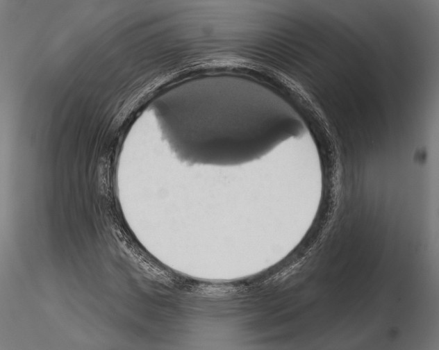 X0000115170825200912091021