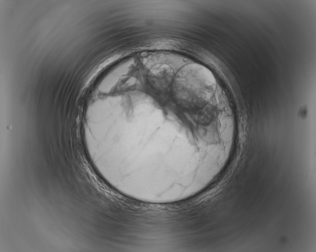 X0000115170827200912091021