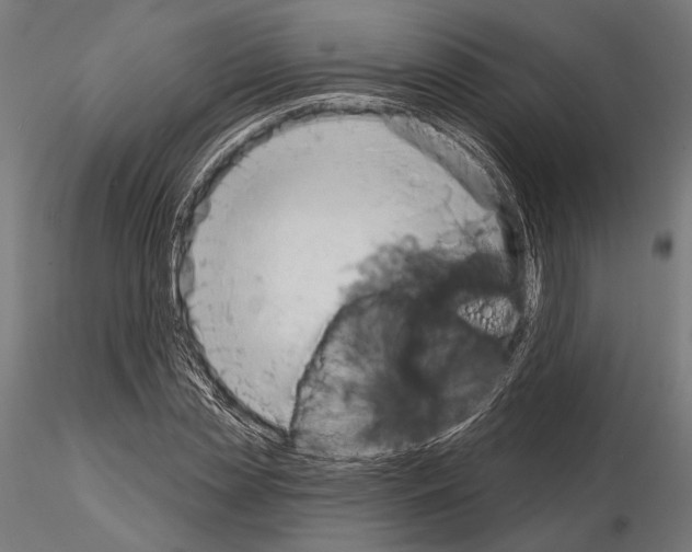 X0000115170829200912091021