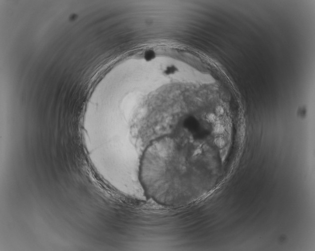 X0000115170833200912091021