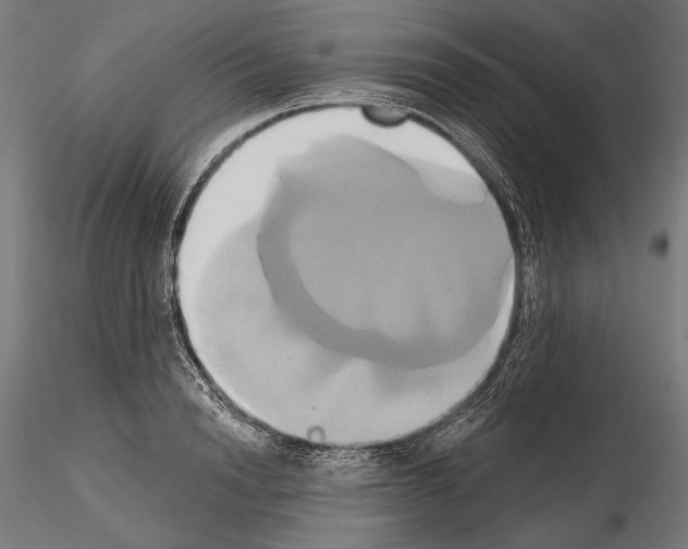 X0000115170846200912091021