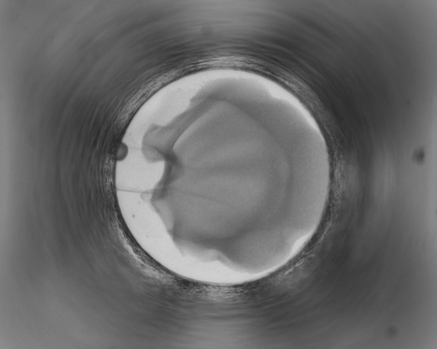 X0000115170849200912091022