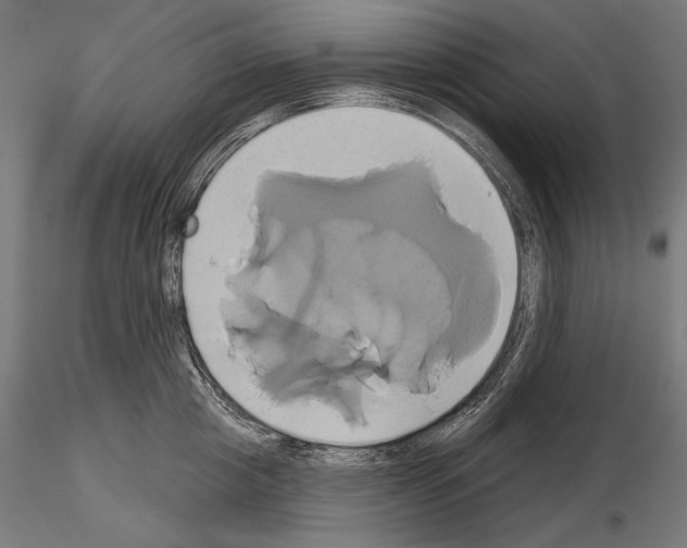 X0000115170857200912091022