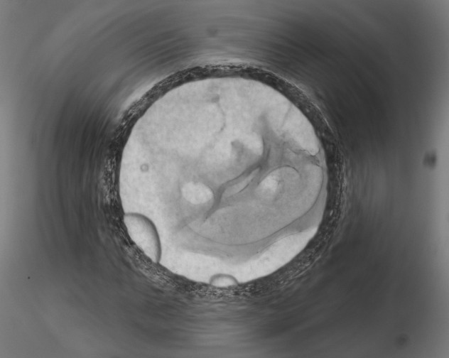 X0000115170871200912091021