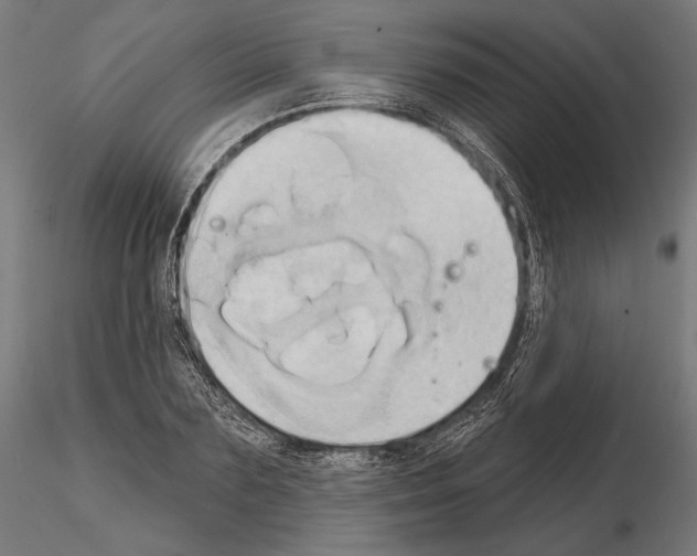 X0000115170883200912091021