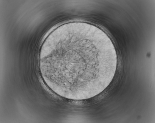 X0000115170911200912091020