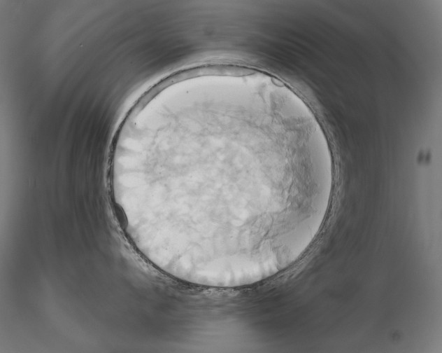 X0000115170912200912091020