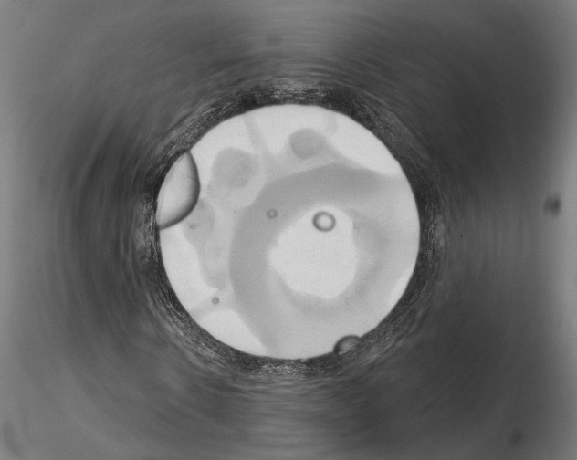 X0000115170914200912091020