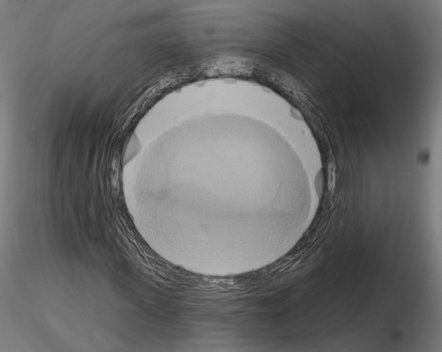 X0000115170915200912091020