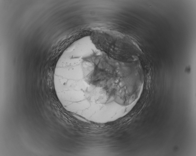 X0000115170917200912091020