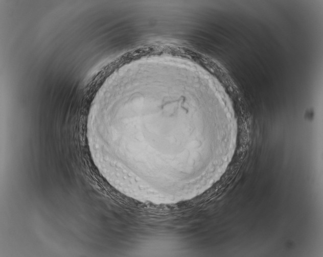 X0000115170919200912091020