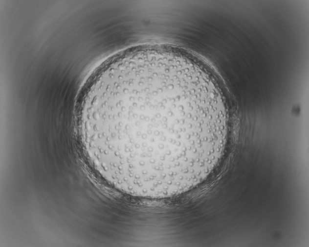 X0000115170927200912091020