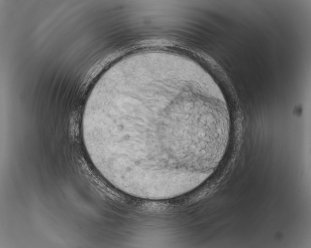 X0000115170929200912091020