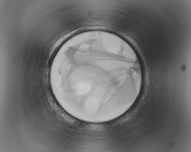 X0000115170933200912091020