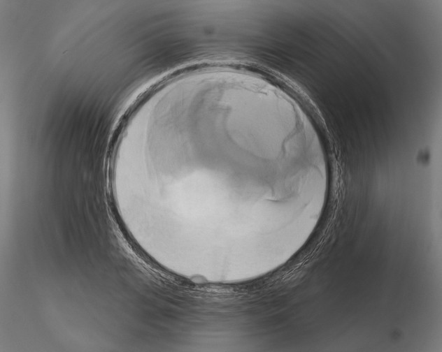 X0000115170935200912091020