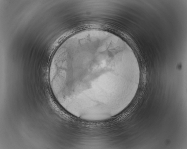 X0000115170938200912091020