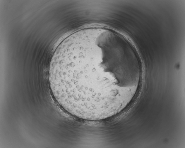 X0000115170953200912091020