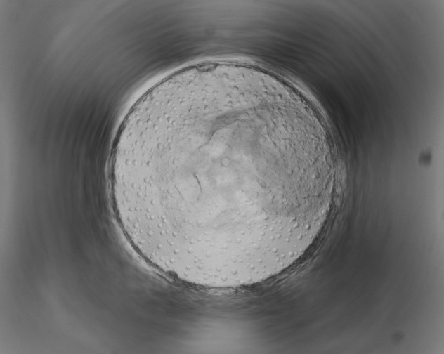 X0000115170959200912091020