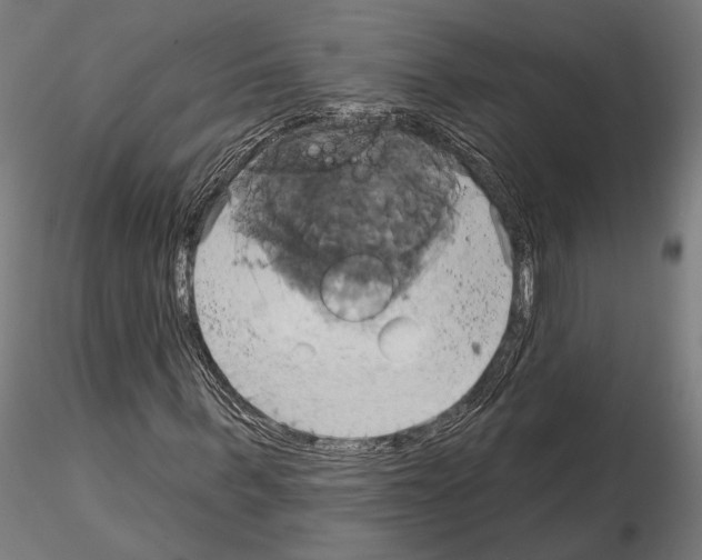 X0000115170963200912091020