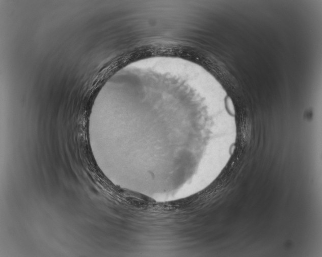 X0000115170964200912091020