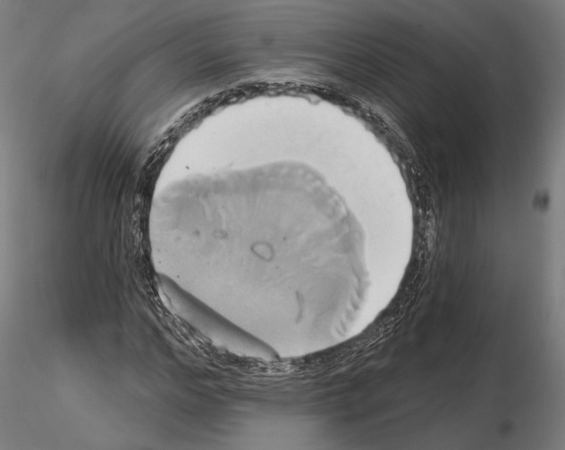 X0000115170968200912091020