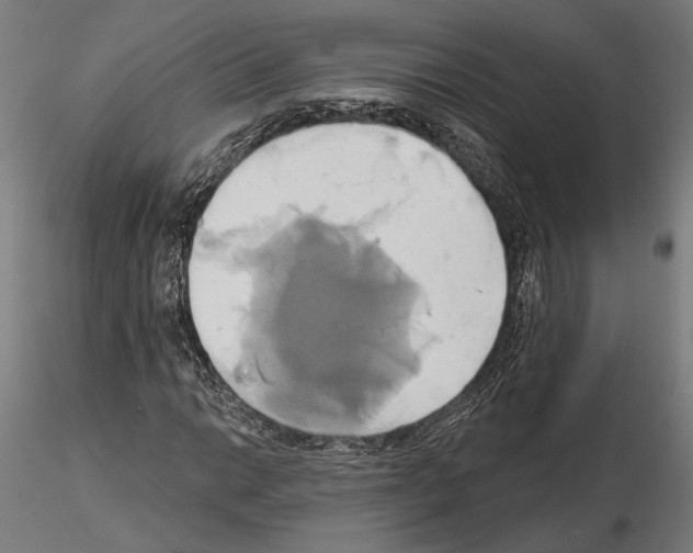 X0000115171014200912091018