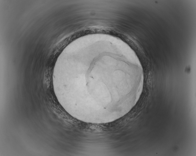 X0000115171015200912091018