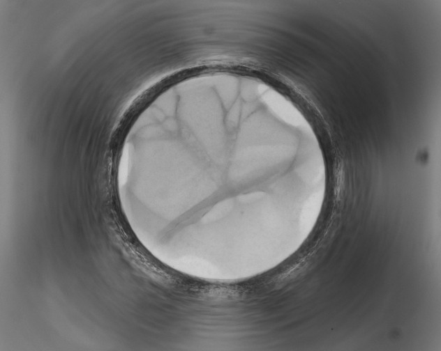 X0000115171021200912091018