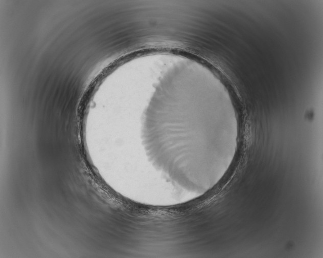 X0000115171022200912091018