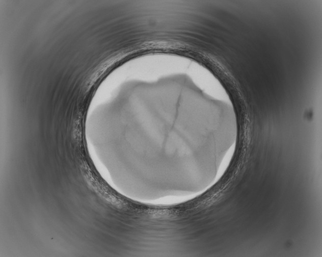 X0000115171025200912091018