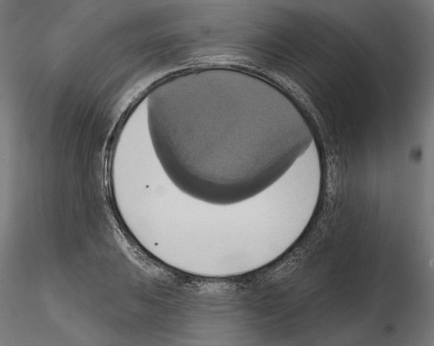 X0000115171031200912091018