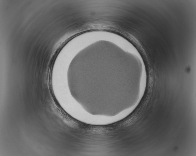 X0000115171035200912091019