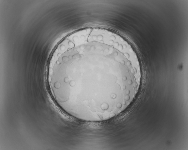 X0000115171040200912091019