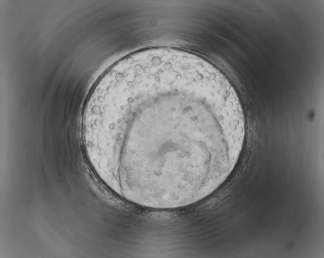 X0000115171044200912091019