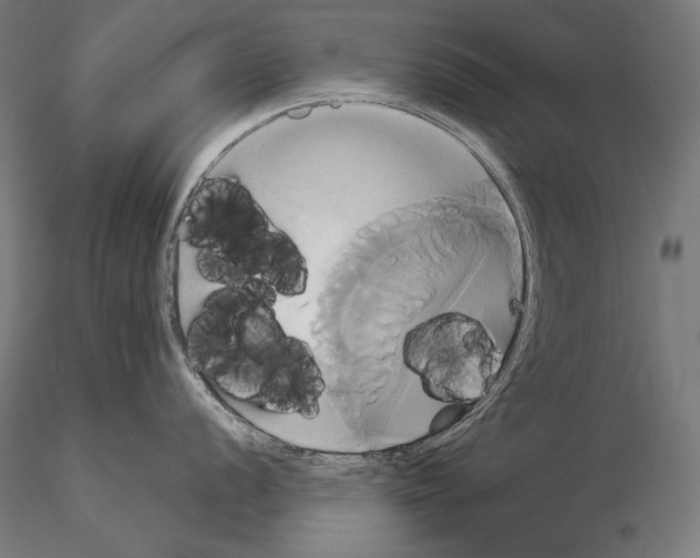 X0000115171056200912091019