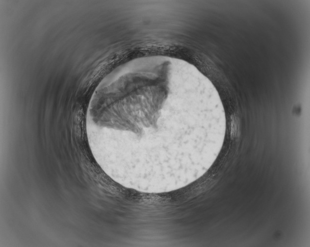 X0000115171059200912091018