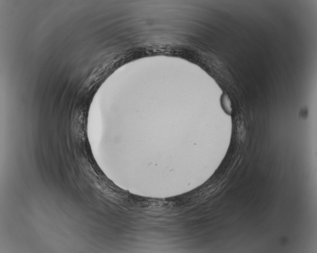 X0000115171060200912091018