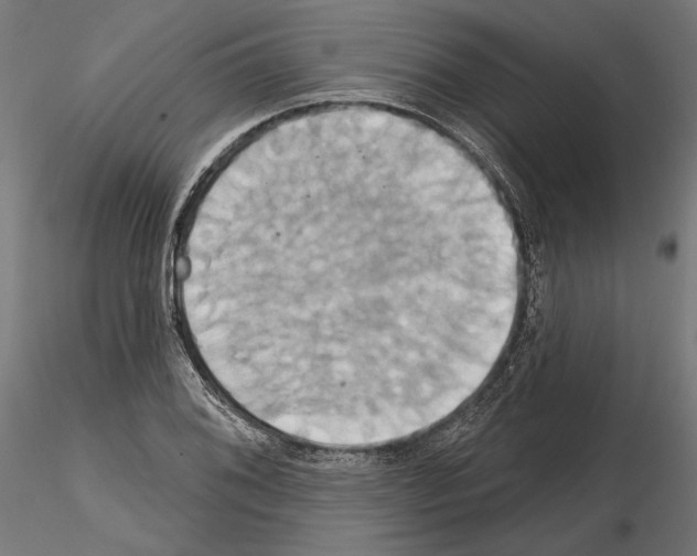 X0000115171076200912091018