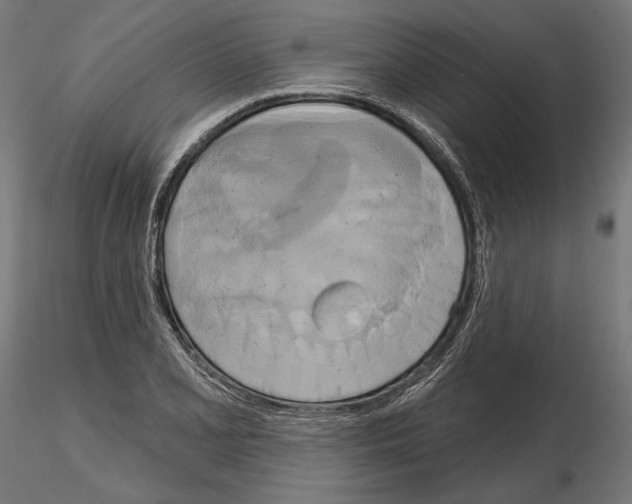 X0000115171077200912091018