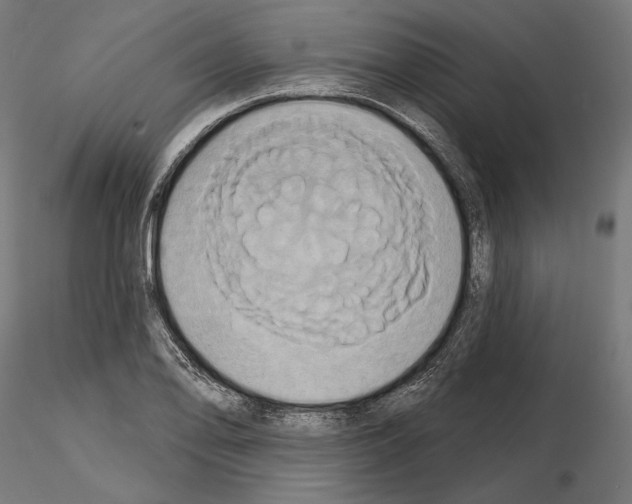 X0000115171078200912091018