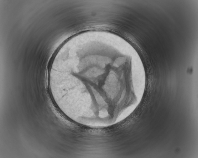 X0000115171079200912091018