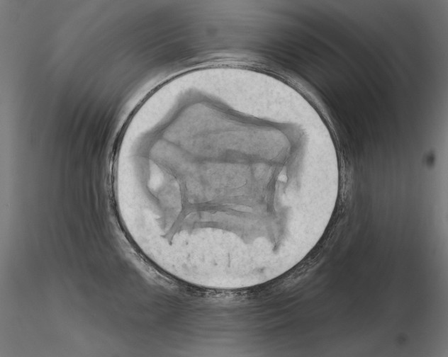 X0000115171099200912091017