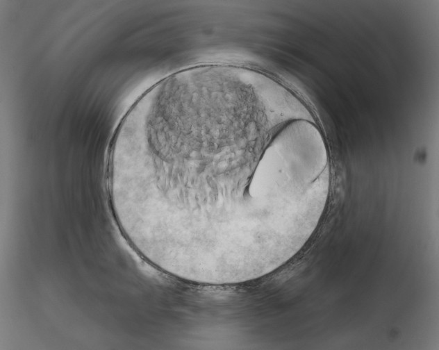 X0000115171103200912091017