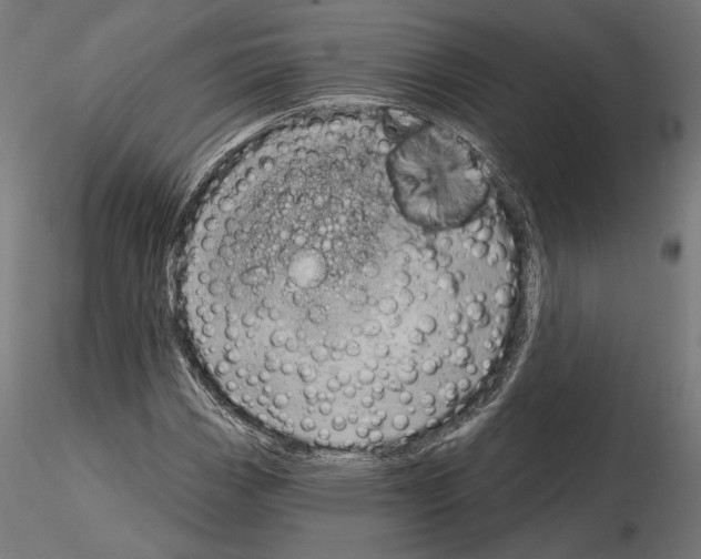 X0000115171113200912091017