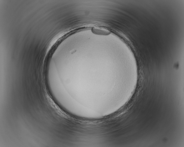 X0000115171122200912091017