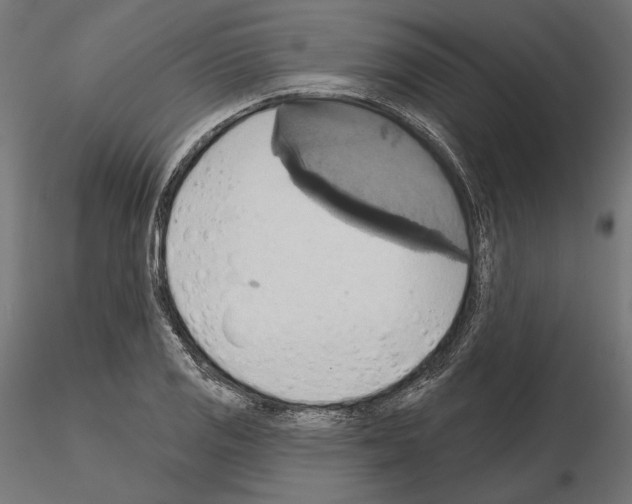 X0000115171125200912091017