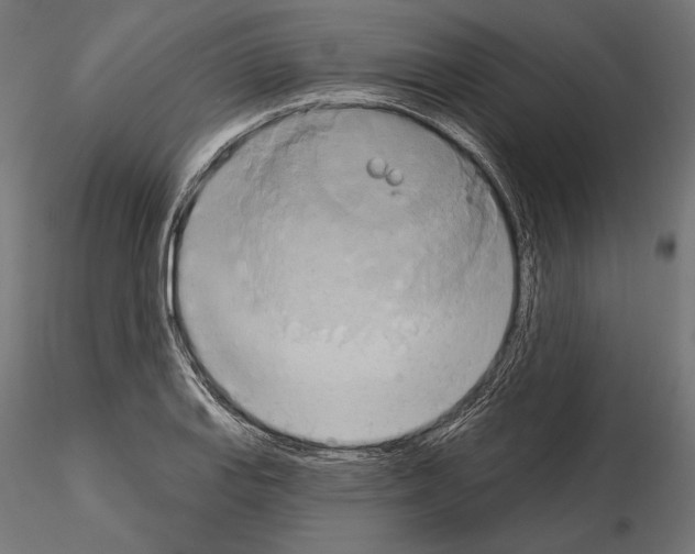 X0000115171127200912091017