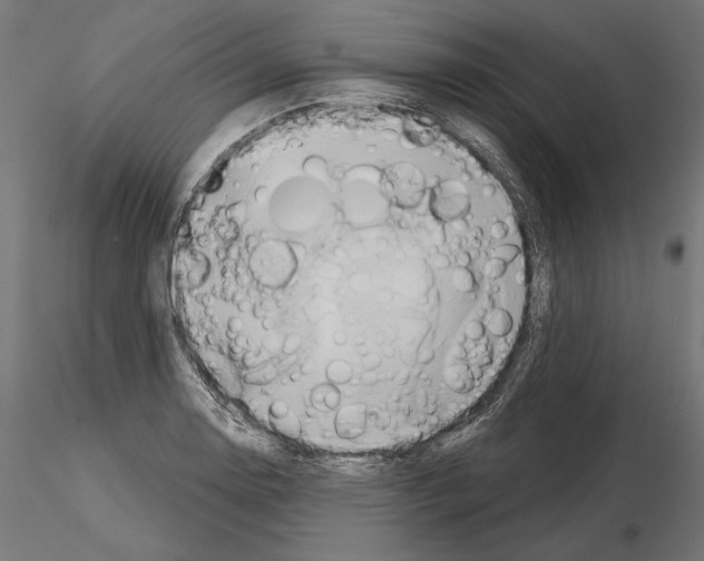 X0000115171130200912091017