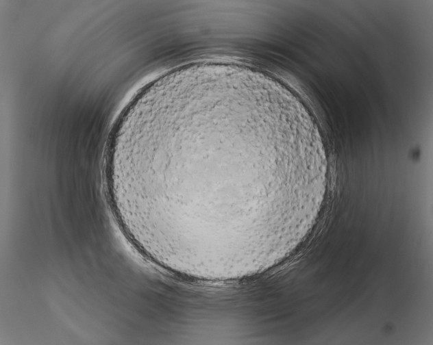 X0000115171139200912091017