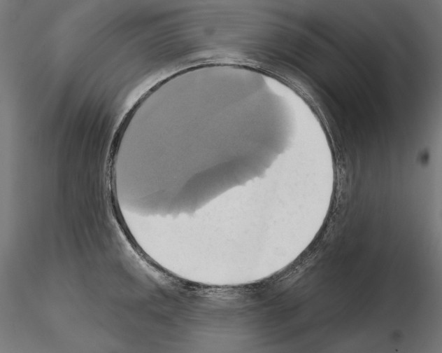 X0000115171141200912091017